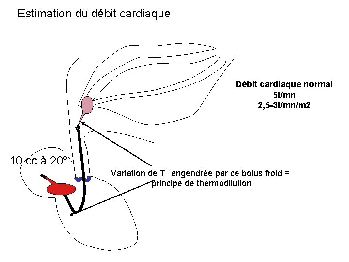 Estimation du débit cardiaque Débit cardiaque normal 5 l/mn 2, 5 -3 l/mn/m 2