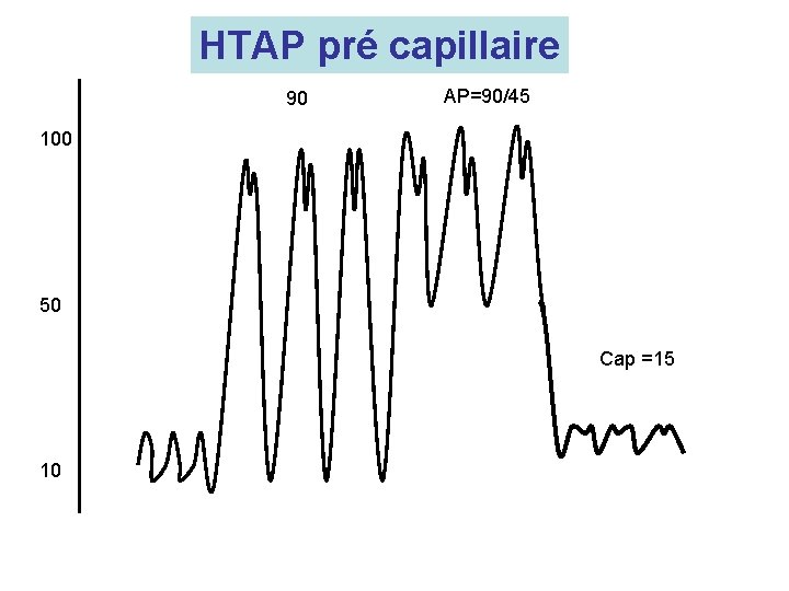 HTAP pré capillaire 90 AP=90/45 100 50 Cap =15 10 