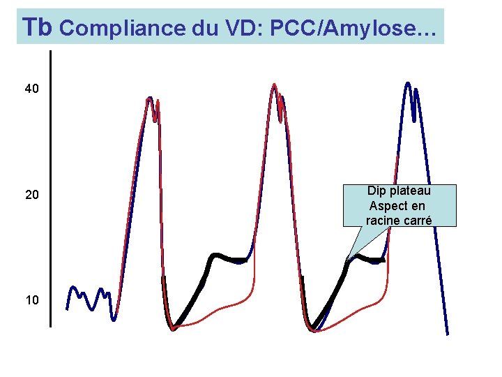 Tb Compliance du VD: PCC/Amylose… 40 20 10 Dip plateau Aspect en racine carré