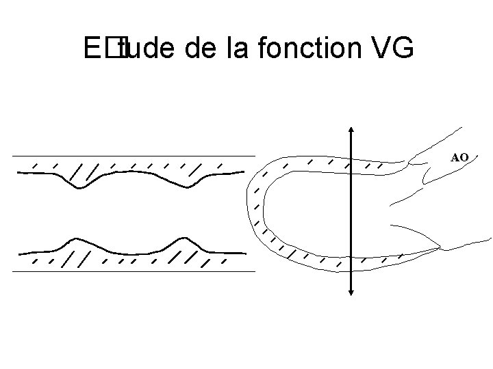 E� tude de la fonction VG AO 
