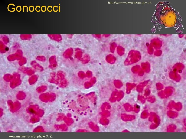 Gonococci www. medmicro. info, photo O. Z. http: //www. warwickshire. gov. uk 