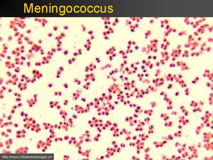 Meningococcus http: //www. infektionsbiologie. ch 