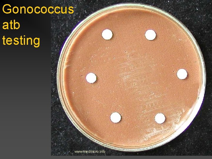 Gonococcus atb testing www. medmicro. info 