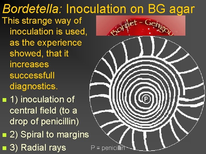 Bordetella: Inoculation on BG agar This strange way of inoculation is used, as the
