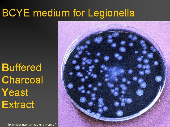 BCYE medium for Legionella Buffered Charcoal Yeast Extract http: //medecinepharmacie. univ-fcomte. fr 
