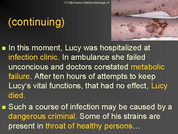 10 http: //www. infektionsbiologie. ch (continuing) n n In this moment, Lucy was hospitalized