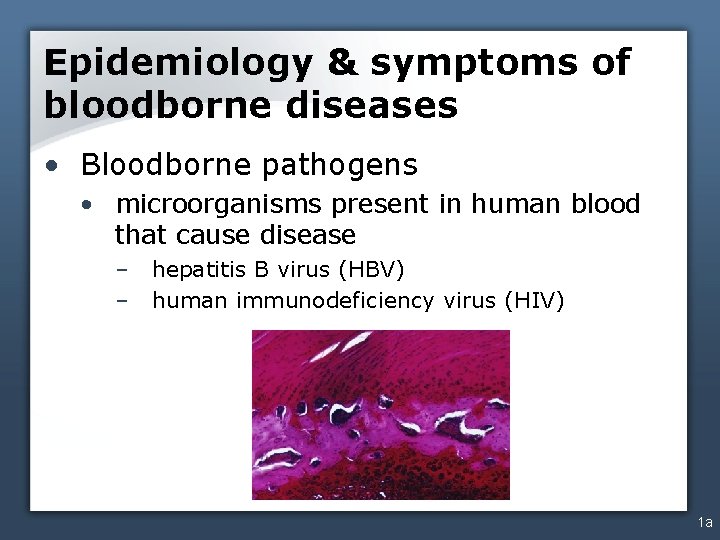 Epidemiology & symptoms of bloodborne diseases • Bloodborne pathogens • microorganisms present in human