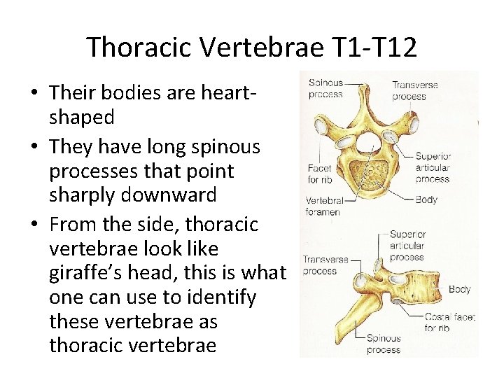 Thoracic Vertebrae T 1 -T 12 • Their bodies are heartshaped • They have