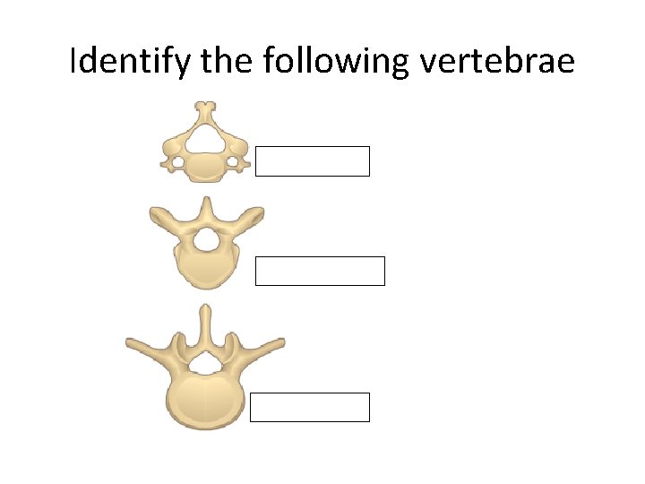 Identify the following vertebrae Identify the following vertebrae