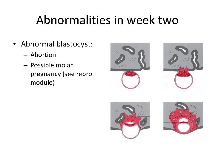 Abnormalities in week two • Abnormal blastocyst: – Abortion – Possible molar pregnancy (see