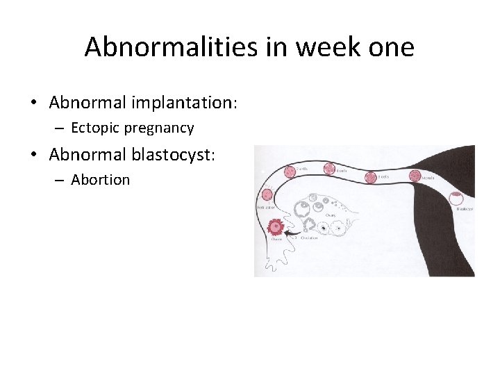 Abnormalities in week one • Abnormal implantation: – Ectopic pregnancy • Abnormal blastocyst: –
