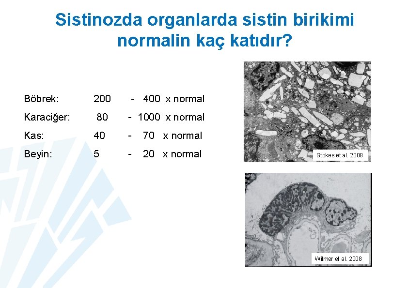 Sistinozda organlarda sistin birikimi normalin kaç katıdır? Böbrek: 200 - 400 x normal Karaciğer: