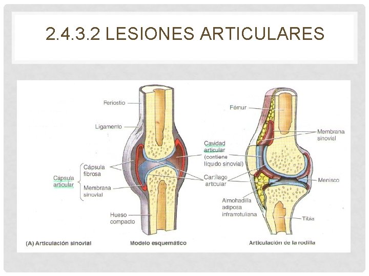 2. 4. 3. 2 LESIONES ARTICULARES 