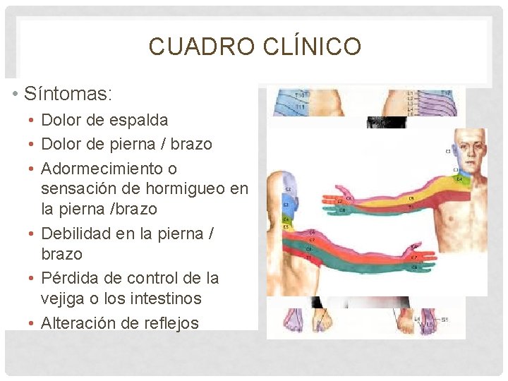 CUADRO CLÍNICO • Síntomas: • Dolor de espalda • Dolor de pierna / brazo