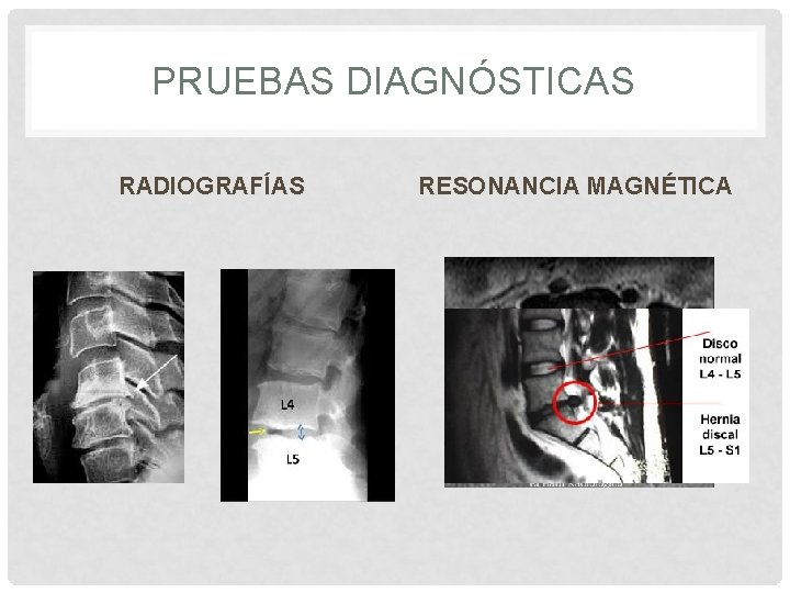 PRUEBAS DIAGNÓSTICAS RADIOGRAFÍAS RESONANCIA MAGNÉTICA 