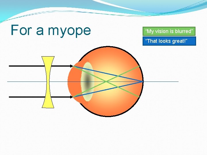 For a myope “My vision is blurred” “That looks great!” 