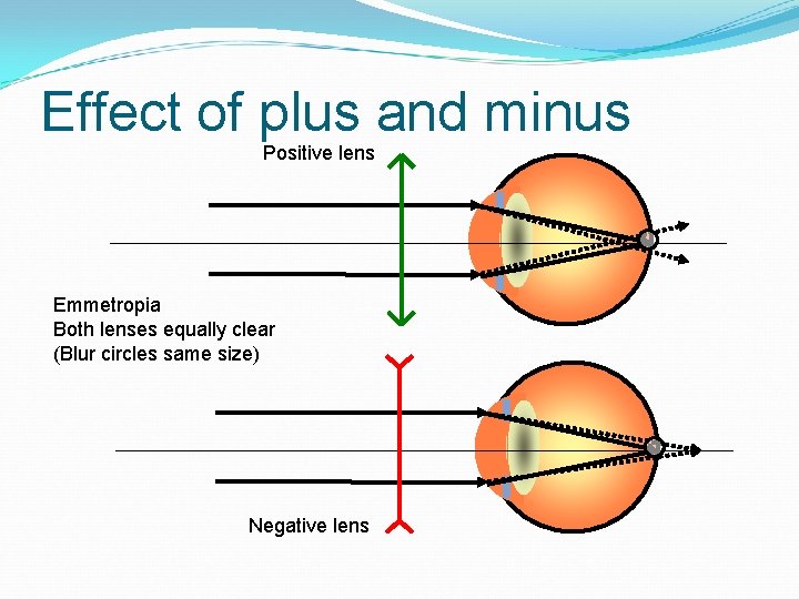 Effect of plus and minus Positive lens Emmetropia Both lenses equally clear (Blur circles