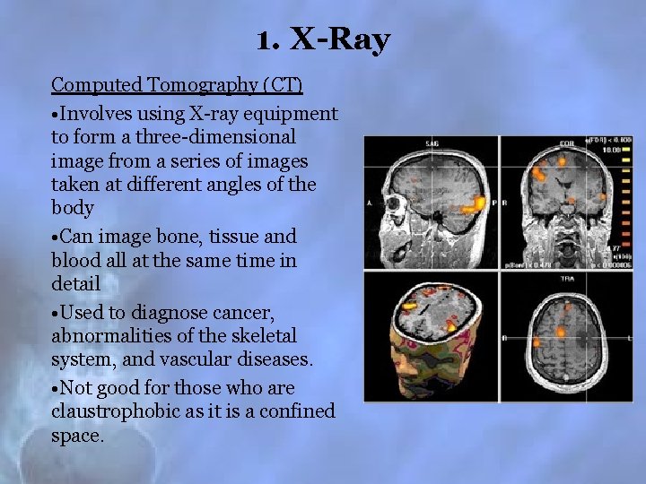 1. X-Ray Computed Tomography (CT) • Involves using X-ray equipment to form a three-dimensional