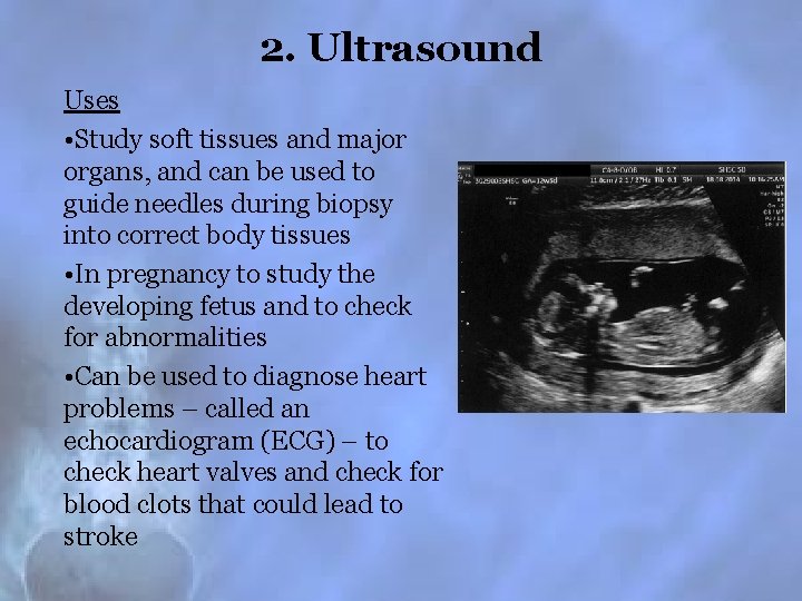 2. Ultrasound Uses • Study soft tissues and major organs, and can be used
