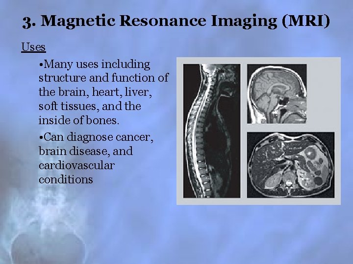 3. Magnetic Resonance Imaging (MRI) Uses • Many uses including structure and function of