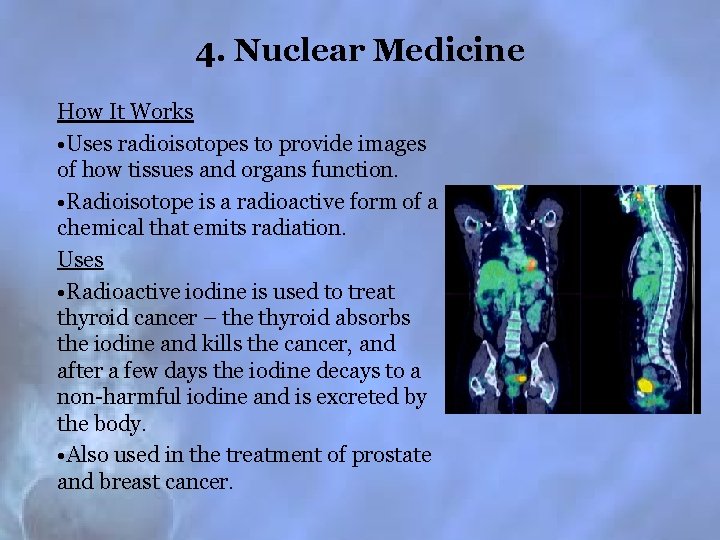 4. Nuclear Medicine How It Works • Uses radioisotopes to provide images of how