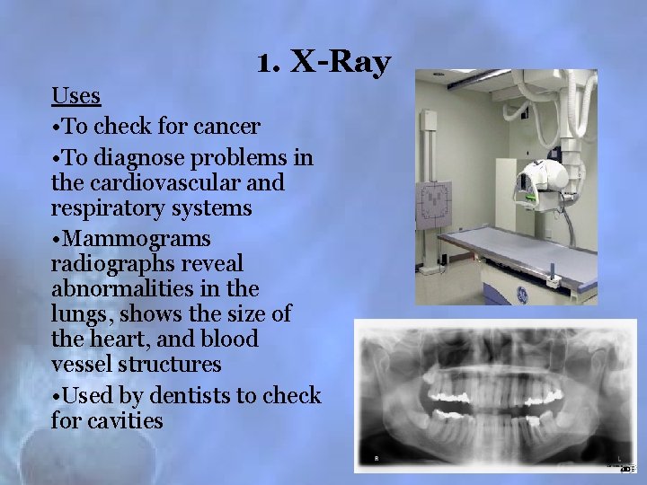 1. X-Ray Uses • To check for cancer • To diagnose problems in the
