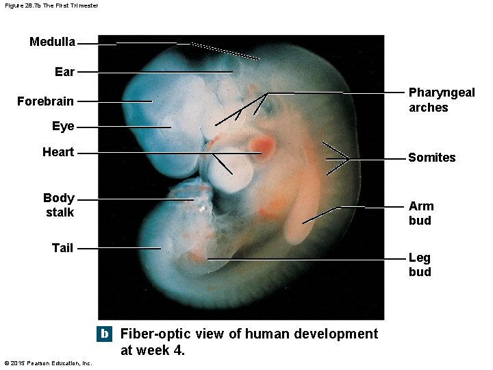 Figure 28. 7 b The First Trimester Medulla Ear Pharyngeal arches Forebrain Eye Heart