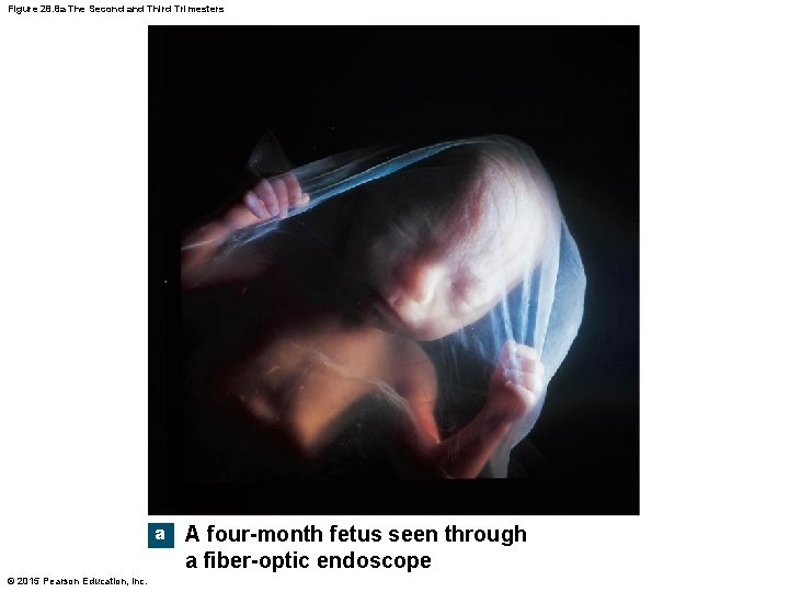 Figure 28. 8 a The Second and Third Trimesters a A four-month fetus seen