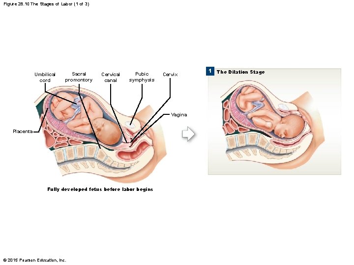 Figure 28. 10 The Stages of Labor (1 of 3) Umbilical cord Sacral promontory