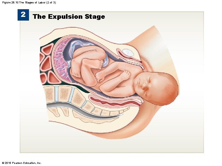 Figure 28. 10 The Stages of Labor (2 of 3) 2 The Expulsion Stage