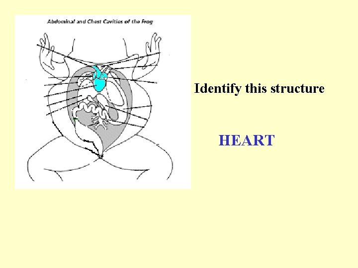 Identify this structure HEART 