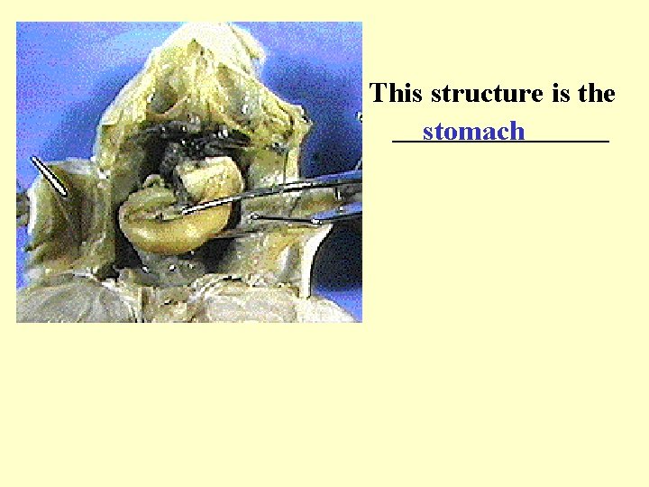 This structure is the ________ stomach 