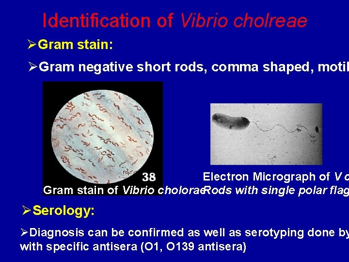 Identification of Vibrio cholreae ØGram stain: ØGram negative short rods, comma shaped, motil Electron