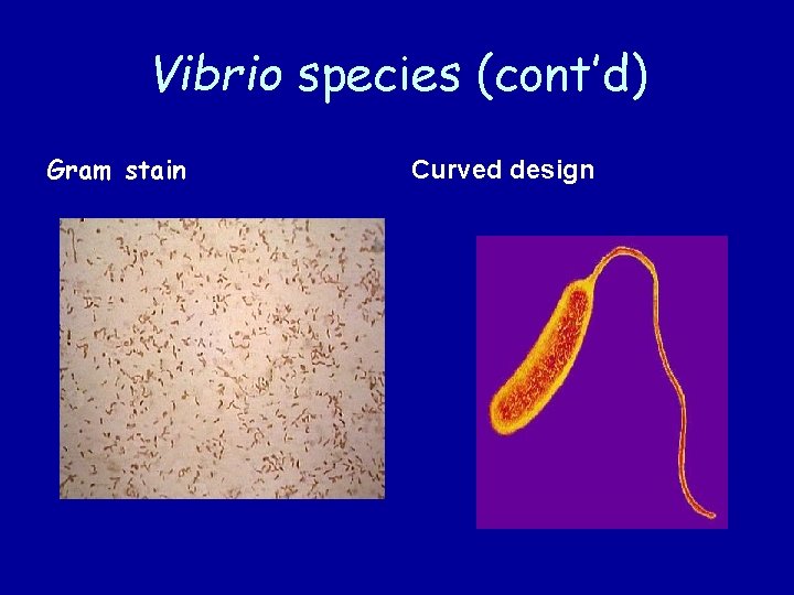 Vibrio species (cont’d) Gram stain Curved design 