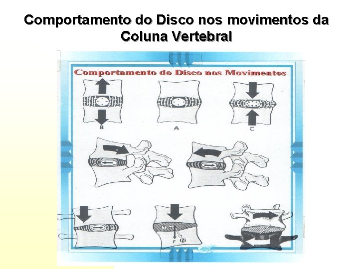 Comportamento do Disco nos movimentos da Coluna Vertebral 