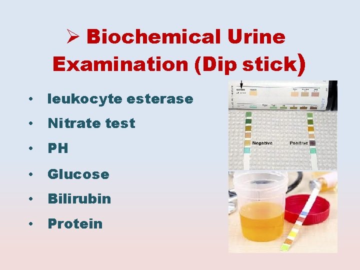  Biochemical Urine Examination (Dip stick) • leukocyte esterase • Nitrate test • PH