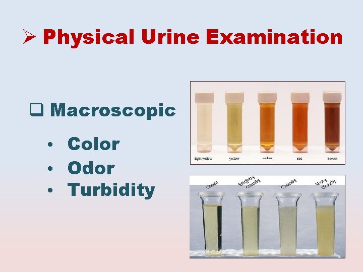  Physical Urine Examination Macroscopic • Color • Odor • Turbidity 