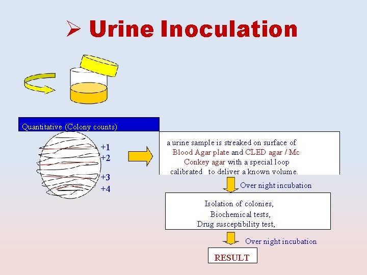  Urine Inoculation Quantitative (Colony counts) +1 +2 +3 +4 a urine sample is