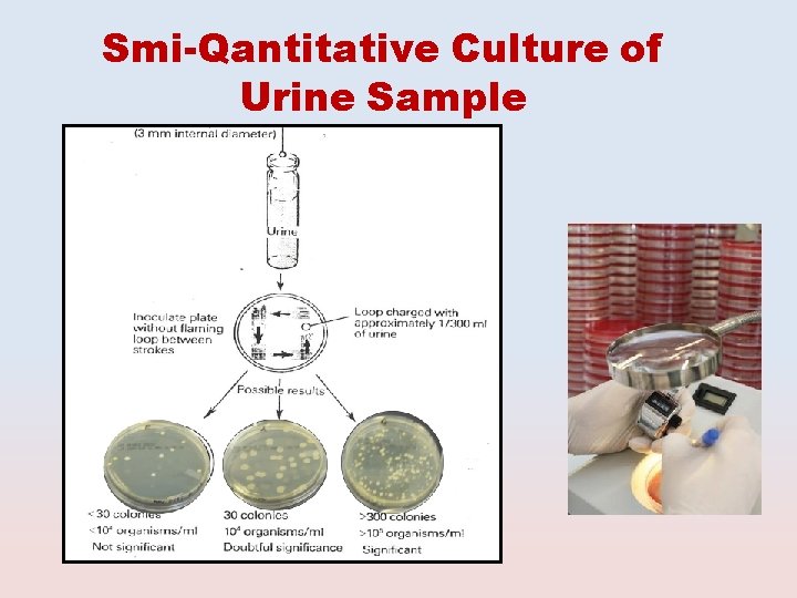 Smi-Qantitative Culture of Urine Sample 