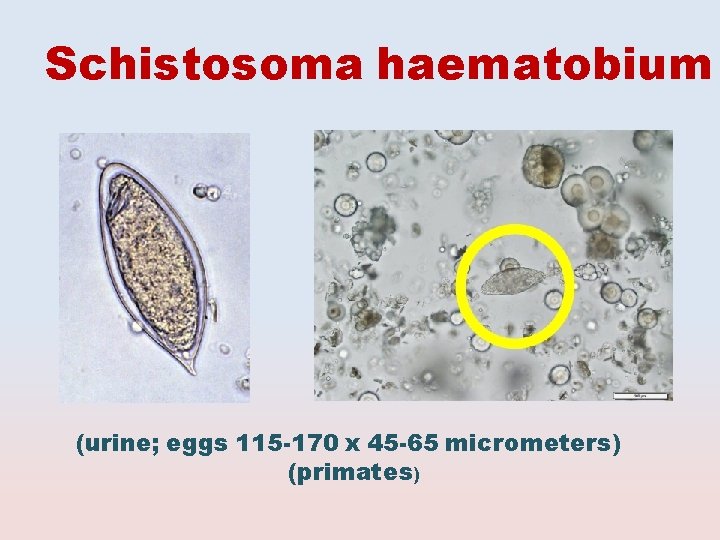 Schistosoma haematobium (urine; eggs 115 -170 x 45 -65 micrometers) (primates) 
