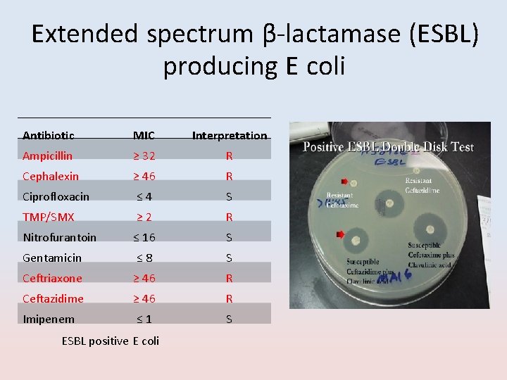 Extended spectrum β-lactamase (ESBL) producing E coli Antibiotic MIC Interpretation Ampicillin ≥ 32 R