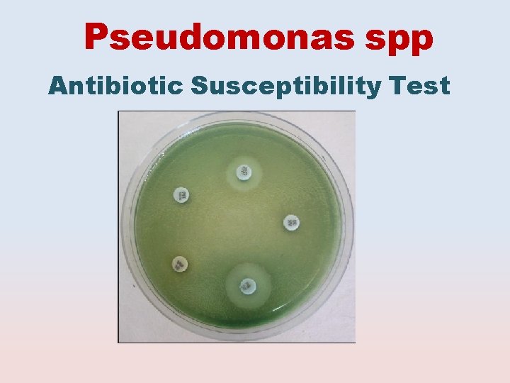 Pseudomonas spp Antibiotic Susceptibility Test 