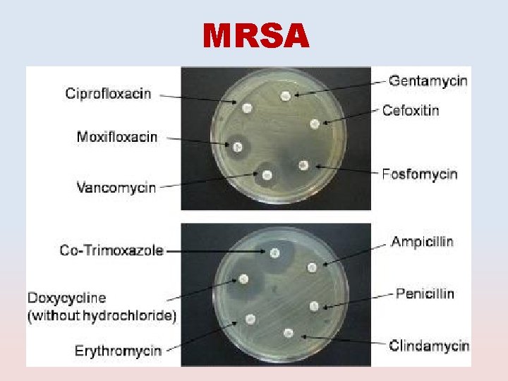 MRSA 