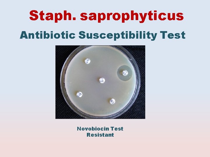 Staph. saprophyticus Antibiotic Susceptibility Test Novobiocin Test Resistant 