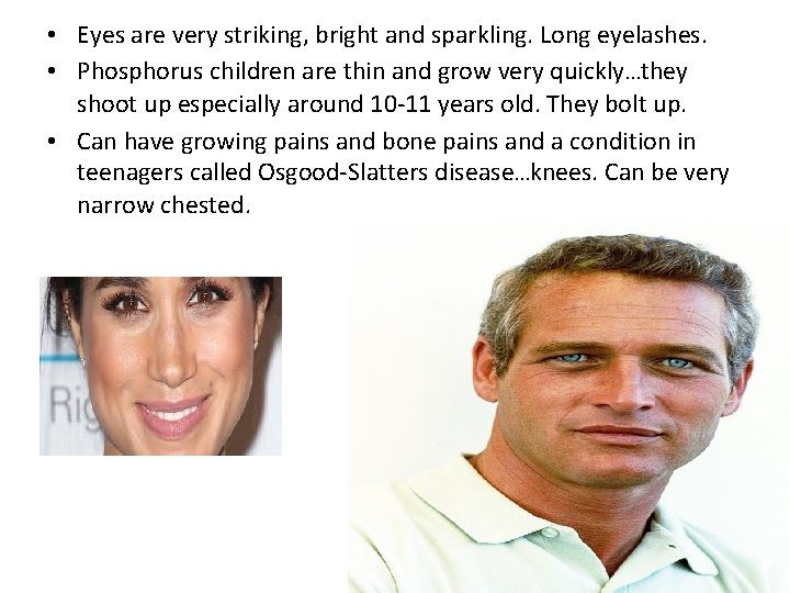 • Eyes are very striking, bright and sparkling. Long eyelashes. • Phosphorus children • Eyes are very striking, bright and sparkling. Long eyelashes. • Phosphorus children