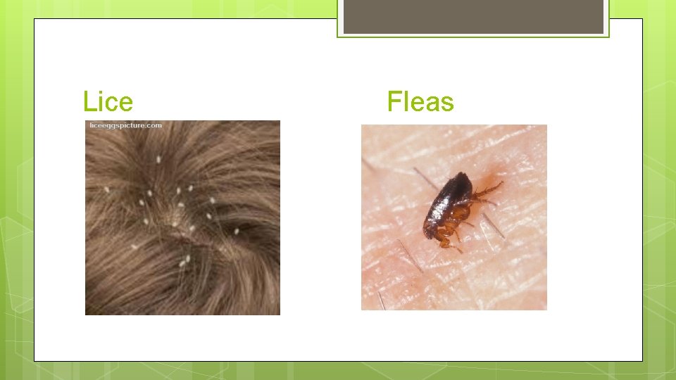 Lice Fleas 