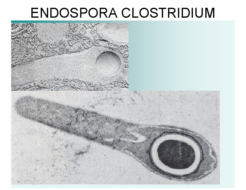 ENDOSPORA CLOSTRIDIUM 