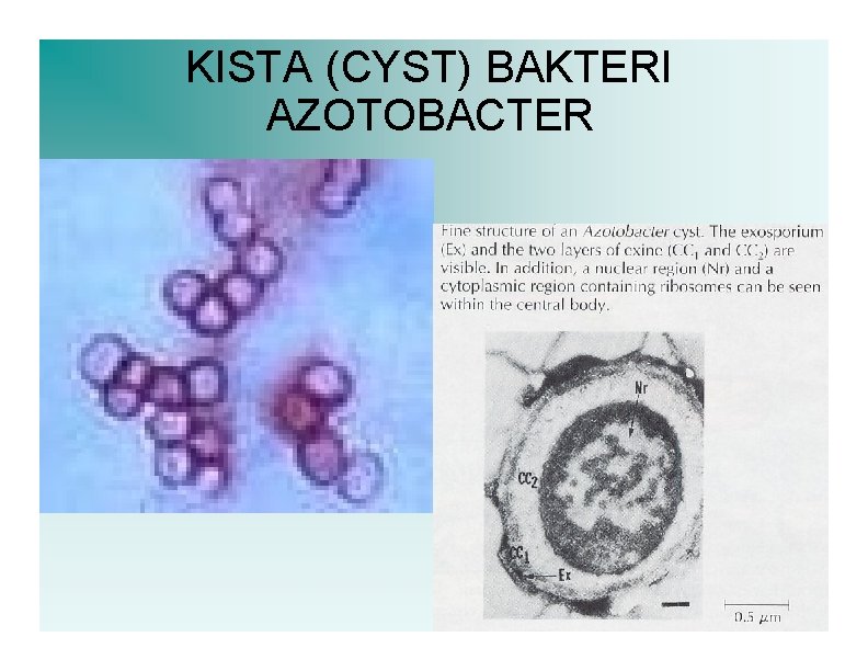 KISTA (CYST) BAKTERI AZOTOBACTER 