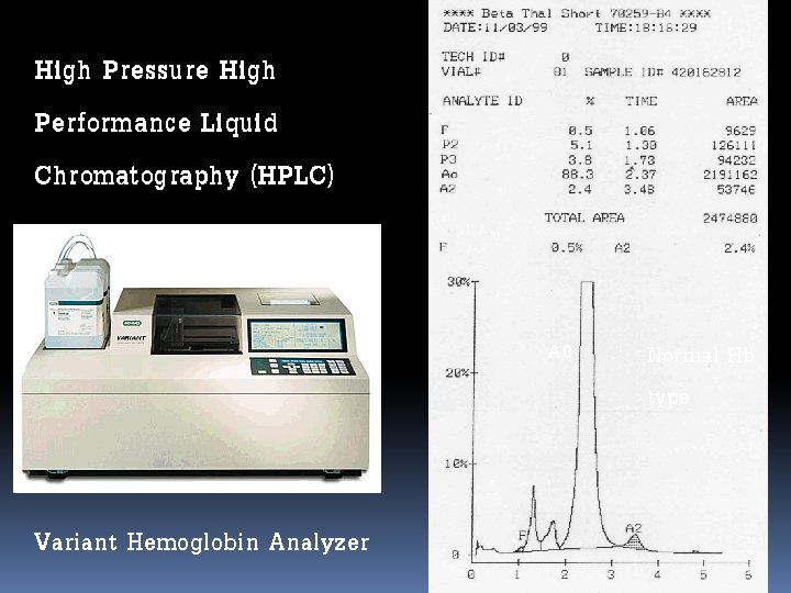 High Pressure High Performance Liquid Chromatography (HPLC) A 0 Variant Hemoglobin Analyzer Normal Hb