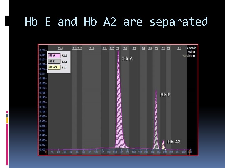 Hb E and Hb A 2 are separated 